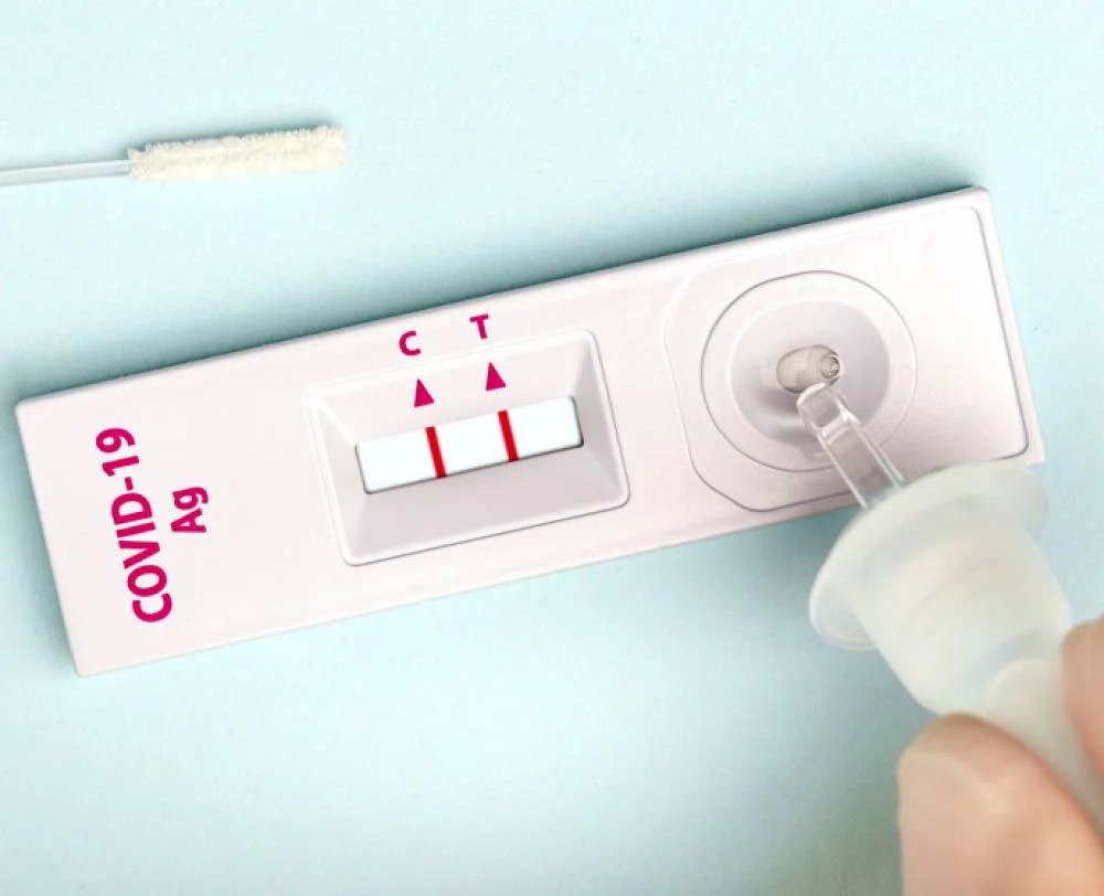 Rapid Test Antigen & Antibodi Untuk Tes Penyaringan Covid-19